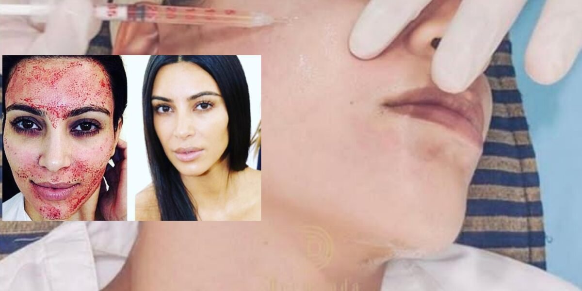 Dermand Clinic تقدم تقنية الـPRP بجودة عالية واهتمامٍ لا مثيل له - صورة مميزة Dermand Clinic تقدم تقنية الـPRP بجودة عالية واهتمامٍ لا مثيل له