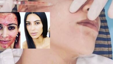 Dermand Clinic تقدم تقنية الـPRP بجودة عالية واهتمامٍ لا مثيل له
